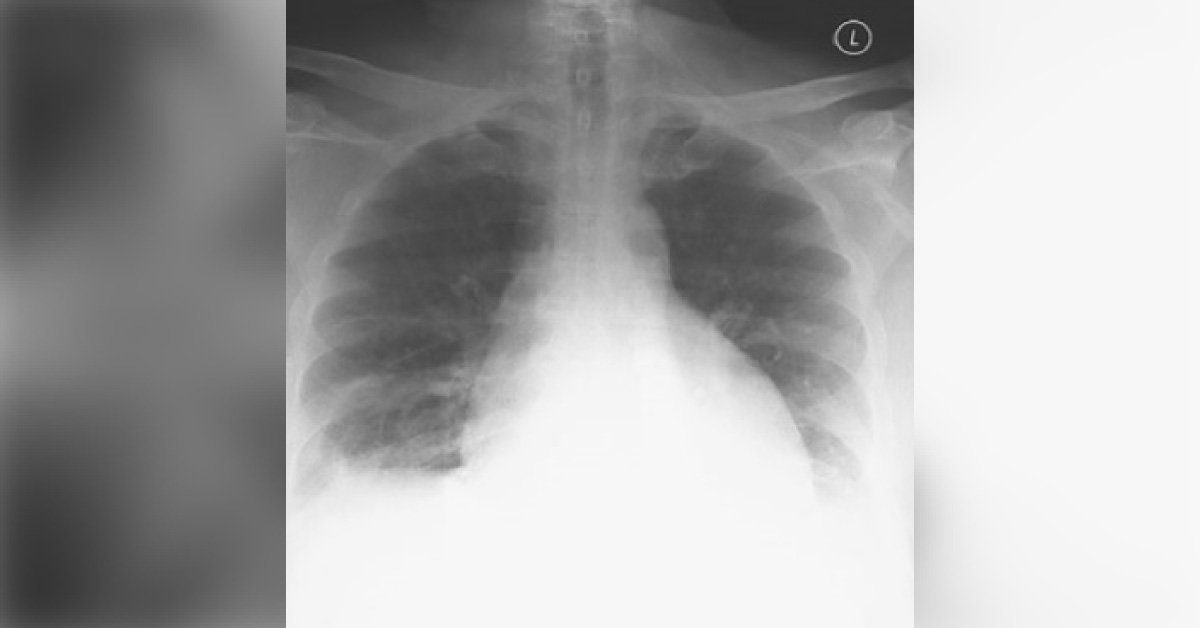 Diagnose And Manage This Patient