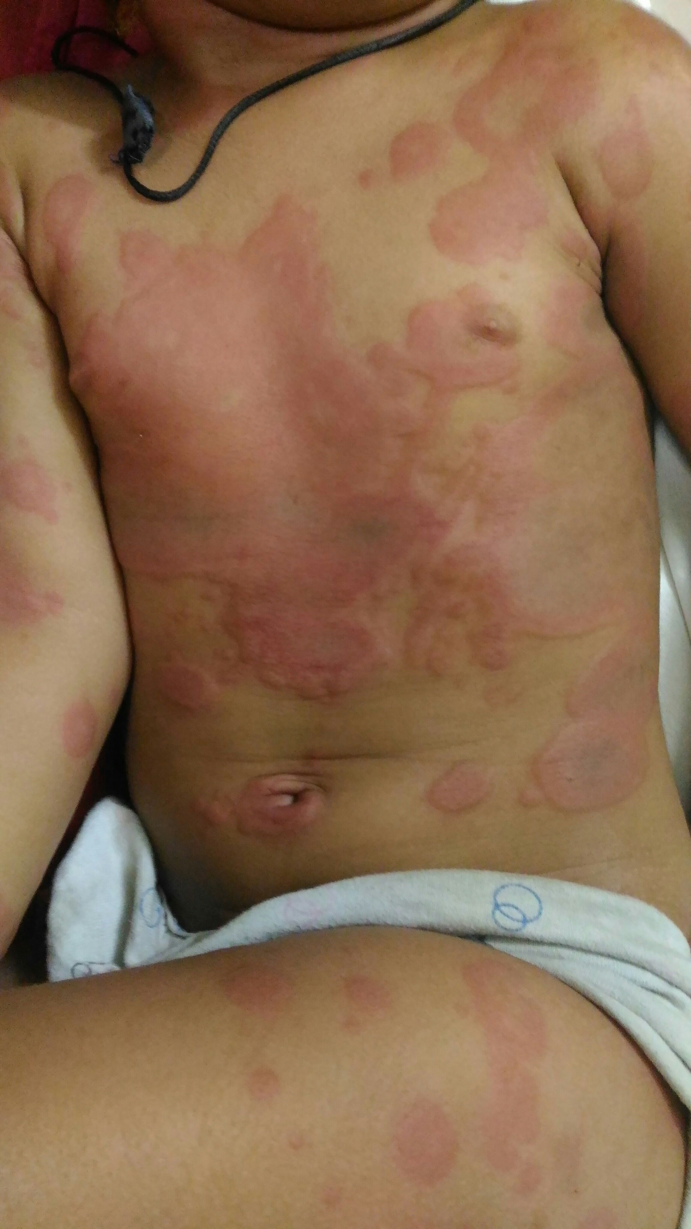 Diagnosis And Treatment