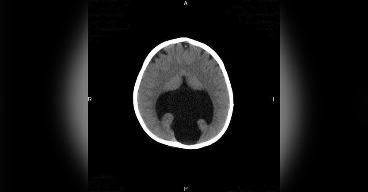 Spot This Congenital Abnormality