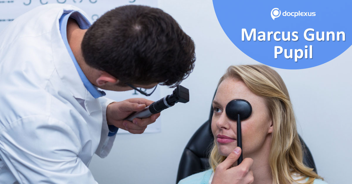 Marcus Gunn Pupil, An Overview