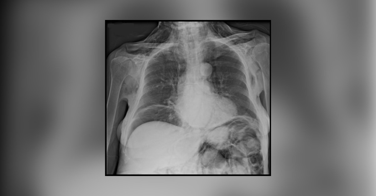Identify The Abnormality