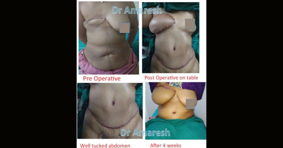 Reconstructing Life- Changing World Through Plastic Surgery