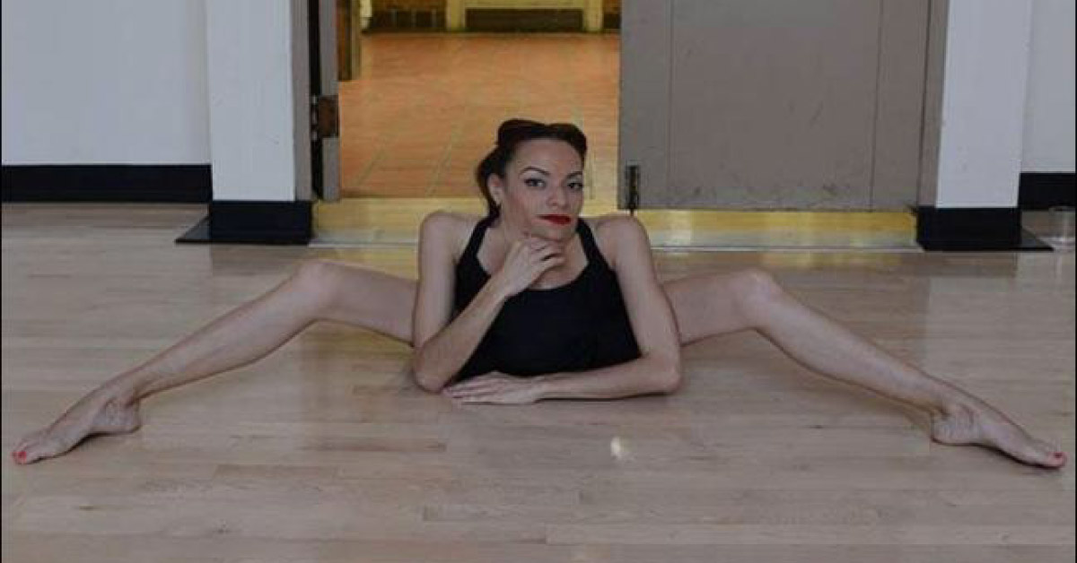 Rare Diseased Girl In Picture Is A Dancer, A Real Boost Up For All Of Us