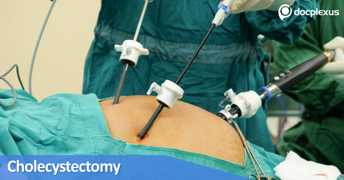 Sphincterotomy for Gallstone In Elderly: With or Without Cholecystectomy?