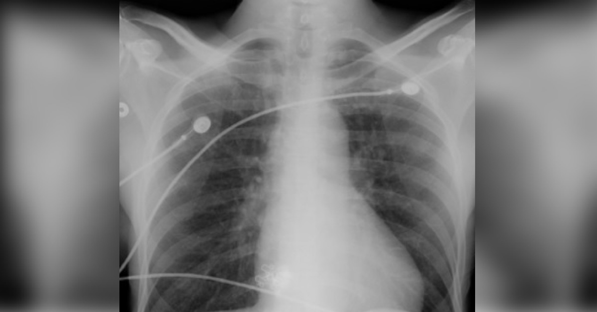 Identify The Cause Of Pain