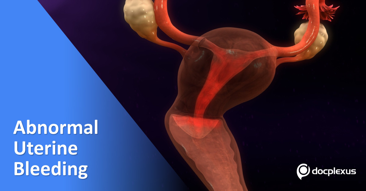 Practice Essentials For Abnormal Uterine Bleeding
