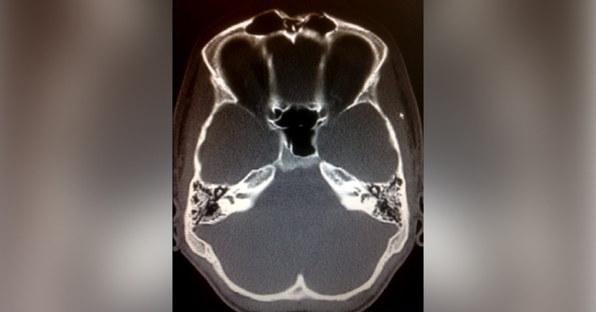 Resolve This ENT Case