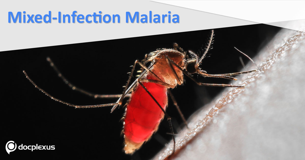 Co-existence Of 4 Malaria Species In Tribal Patient
