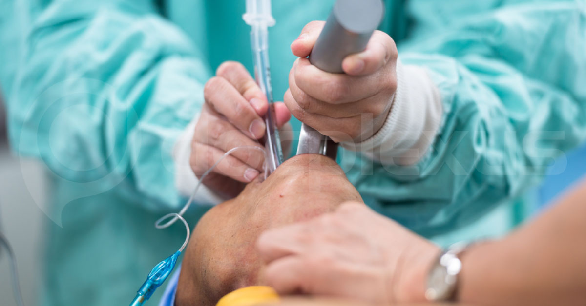 Failed Tracheal Intubation in Pediatrics, What Next?
