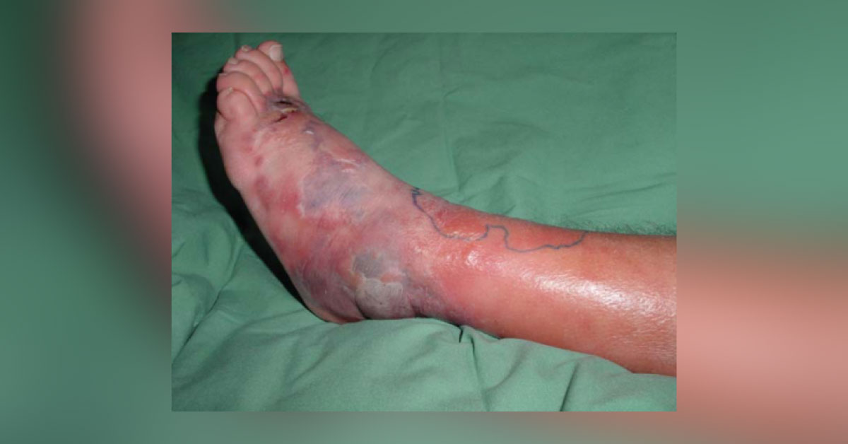 Identify The Dermatology Case
