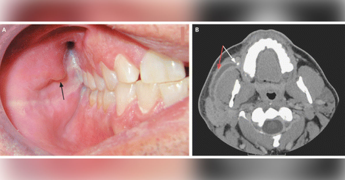 Identify This Condition