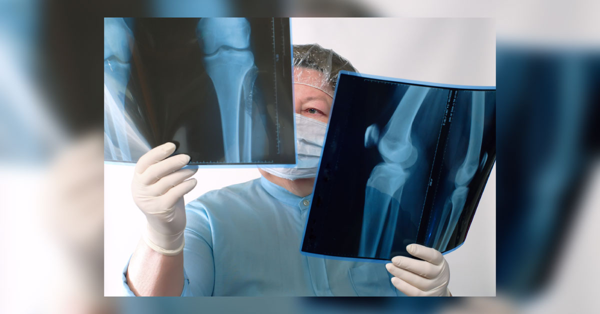 Bone Health In Cancer Patients