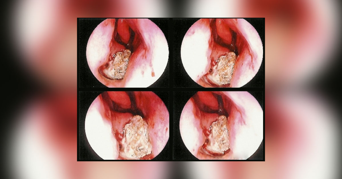 ENT Spot Diagnosis