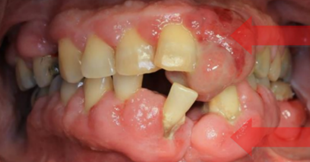 Diagnose This Condition