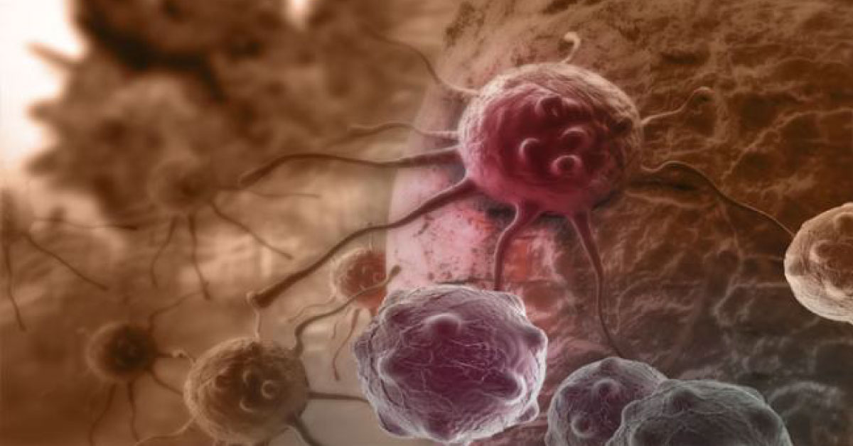 Jetlag Drug To Prevent Painful Effect Of Cancer Chemotherapy