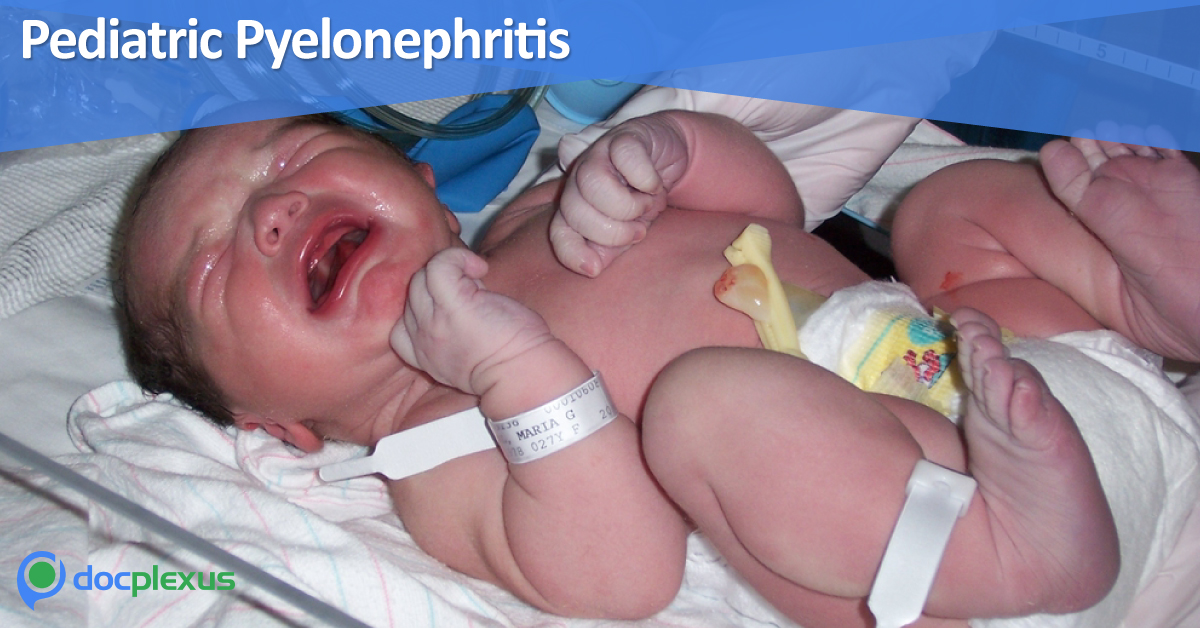 Managing Pediatric Pyelonephritis, Antibiotic Therapy