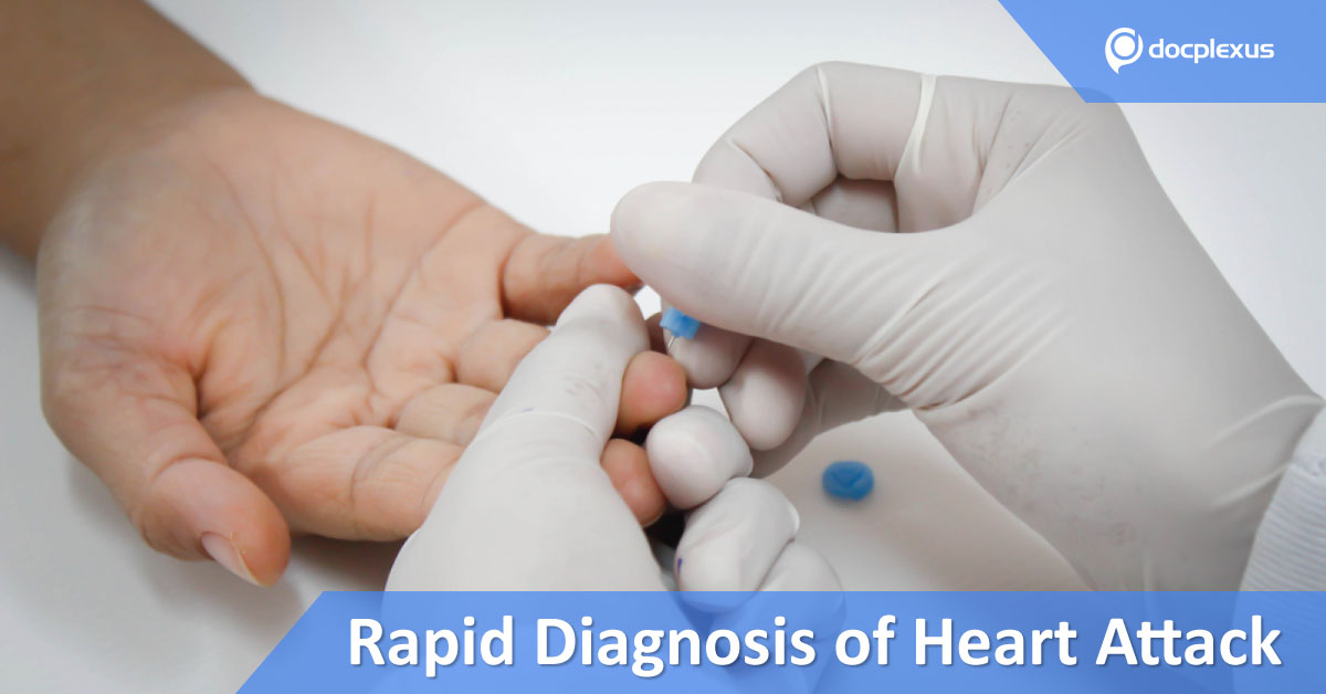 Rapid Point-Of-Care Diagnosis Of Heart Attack