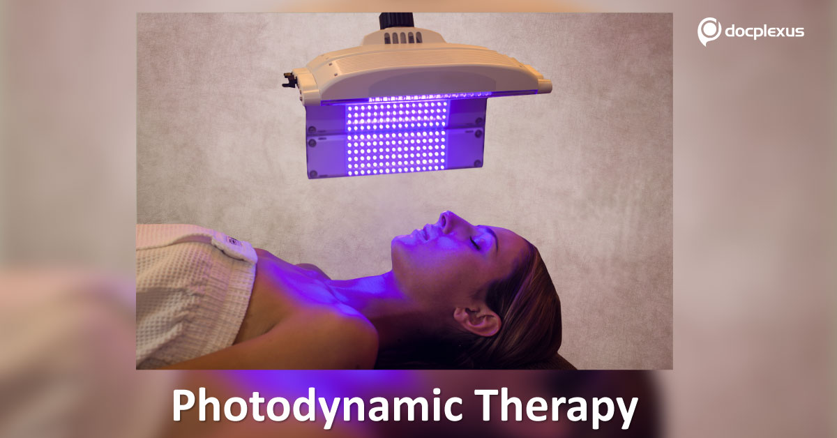 Insights Of Photodynamic Therapy (PDT) For Acne