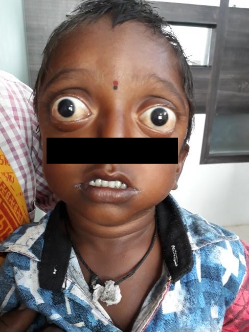 What Is This Entity And It's Causes