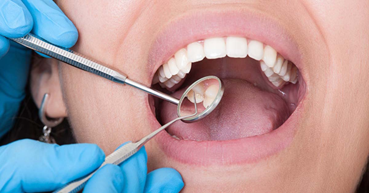 Asthma And Oral Health, The Underlying Connection