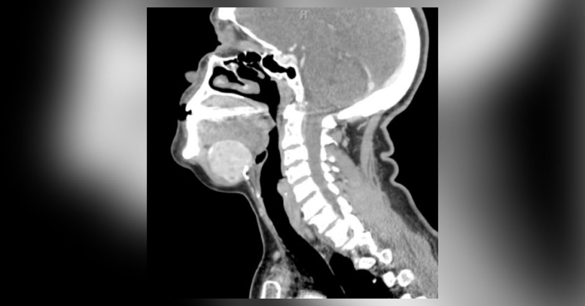 Identify This Radiology Condition