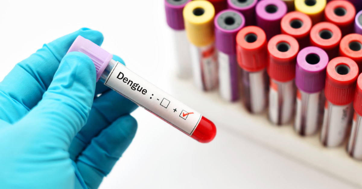 Diagnosis Of Dengue