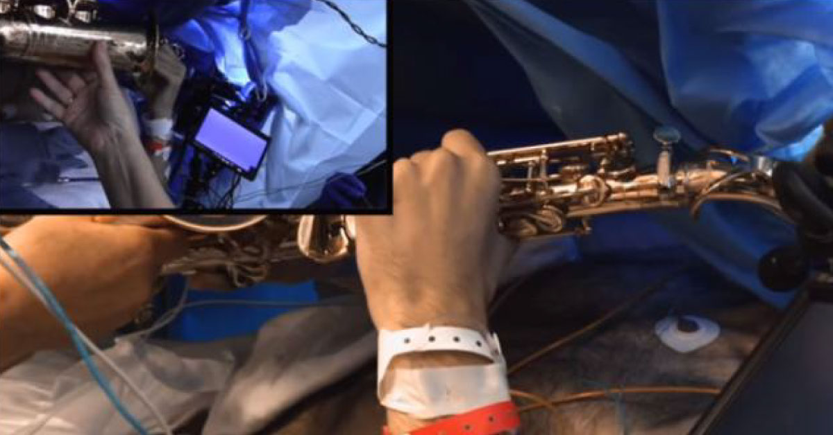 Brain Surgery On A Patient Playing A Saxophone