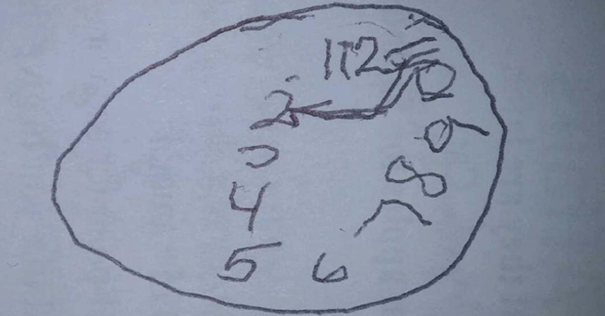 What Is This Neurological Disorder?
