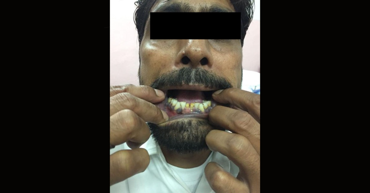 Why Blue Gums?