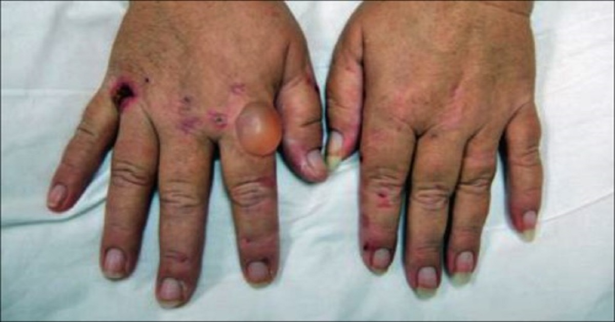 What Is This Condition
