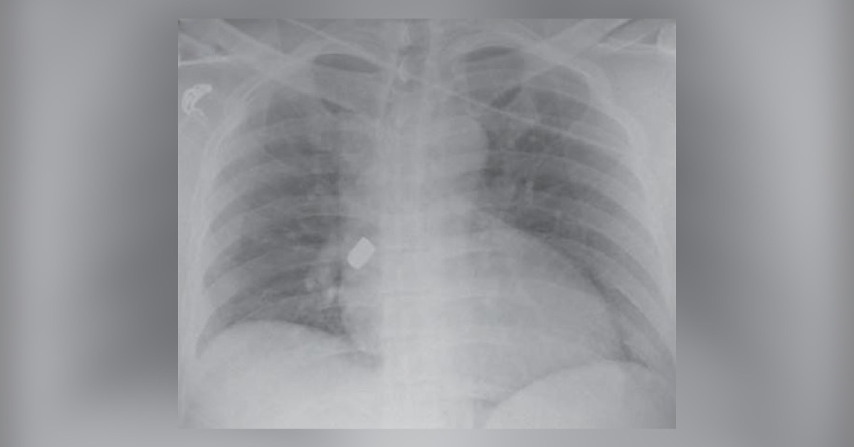 What Would Be Your Next Step In This Trauma Case