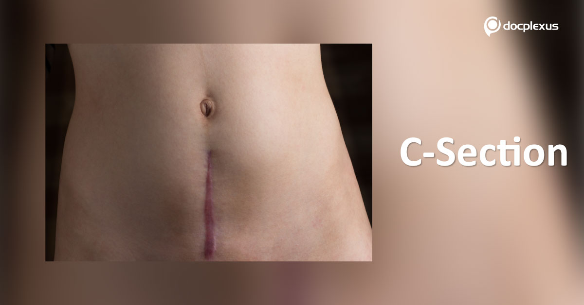 C-Sections Now, More Hysterectomy Complications Later?