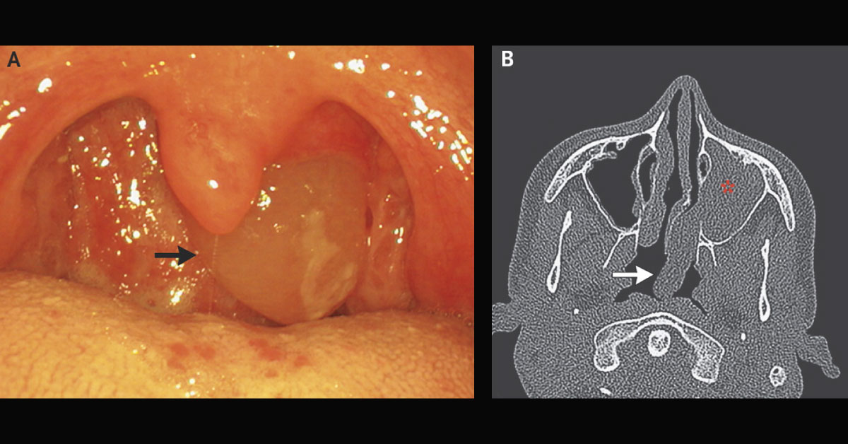 Identify This Condition In A Young Boy