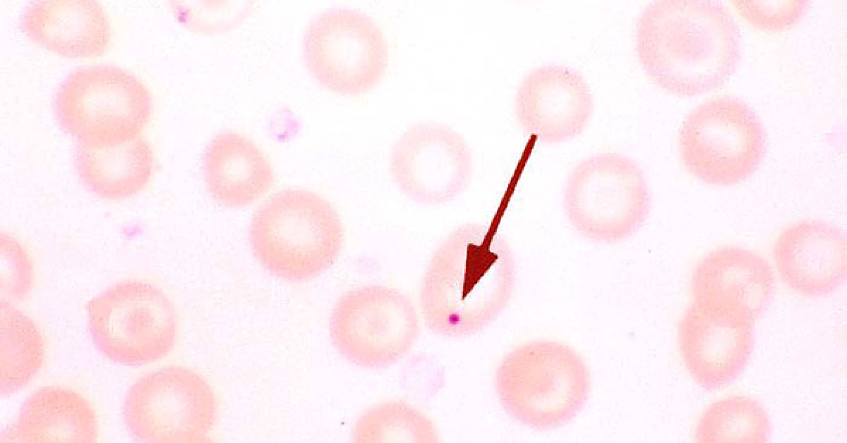 Guess The Pathological Condition