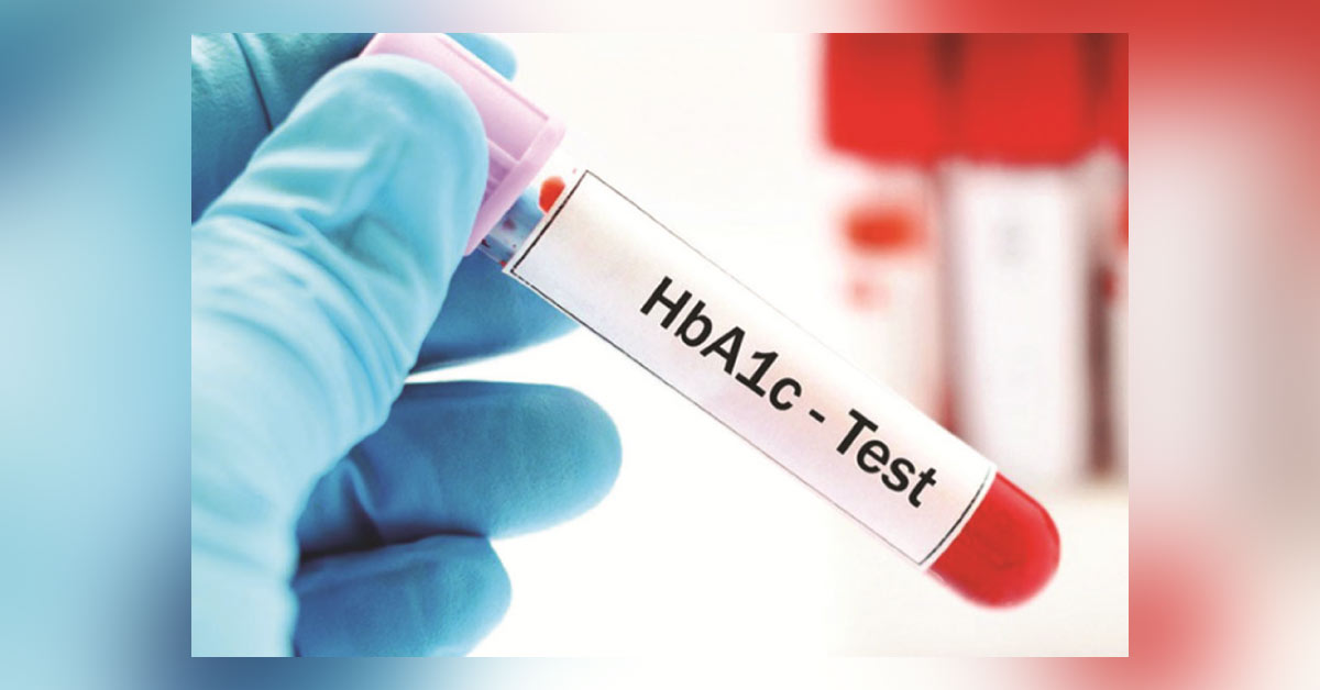 HbA1c Test, How Often Do You Recommend?