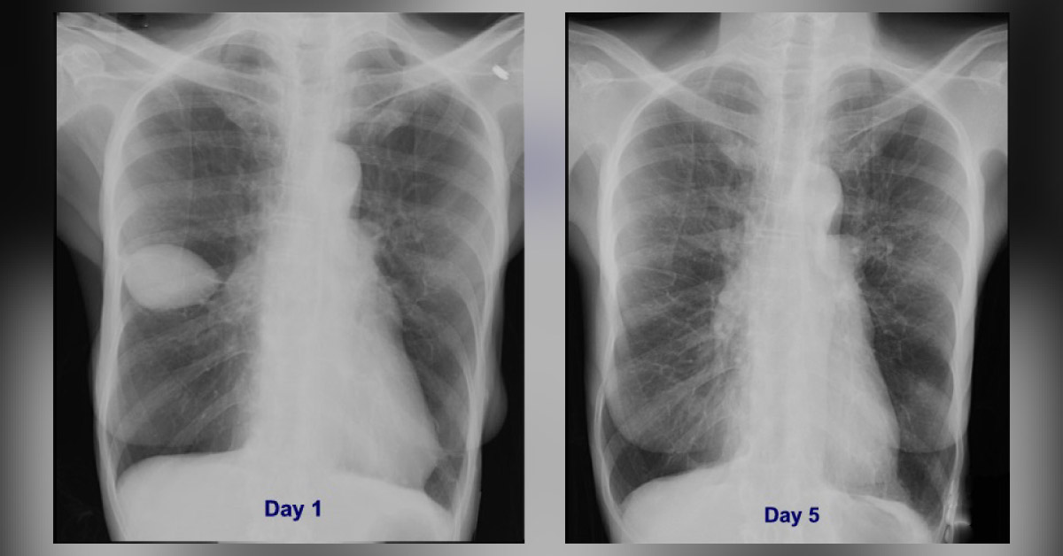 Image Based Diagnosis