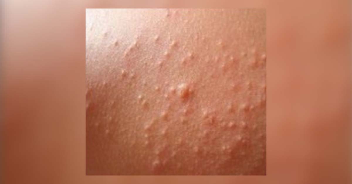 Diagnose This Dermatology Case