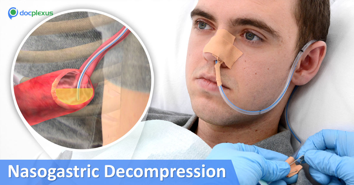 Is Routine Nasogastric Decompression Really Necessary For Small Bowel Obstruction?