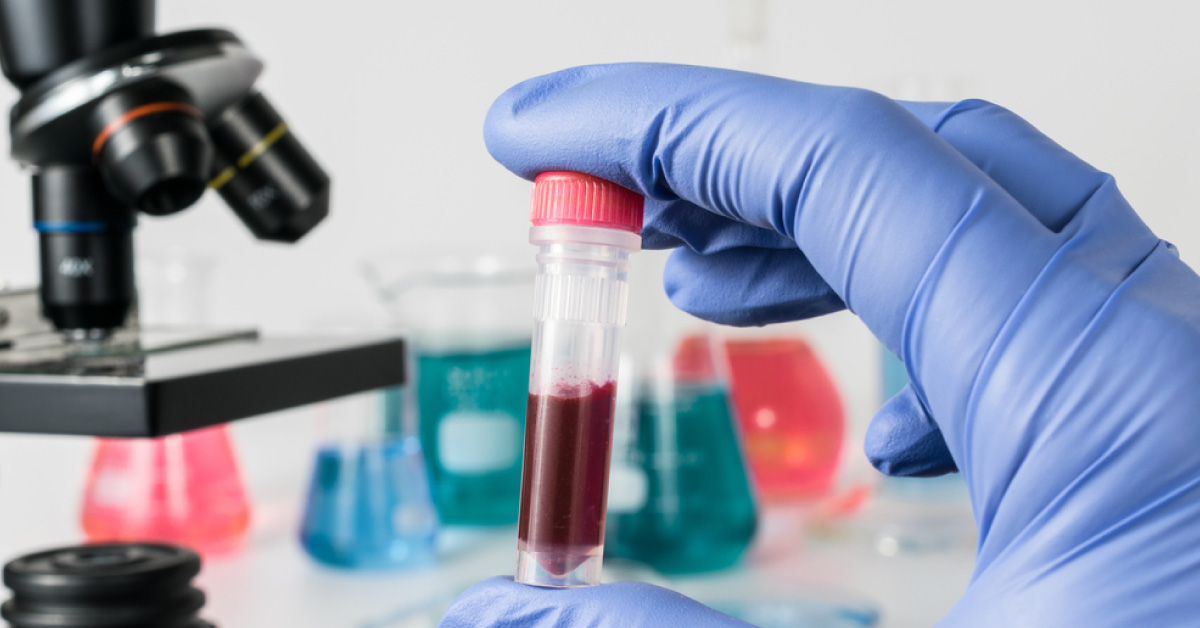 Rapid Diagnostic Test To Distinguish Bacterial From Viral Infections