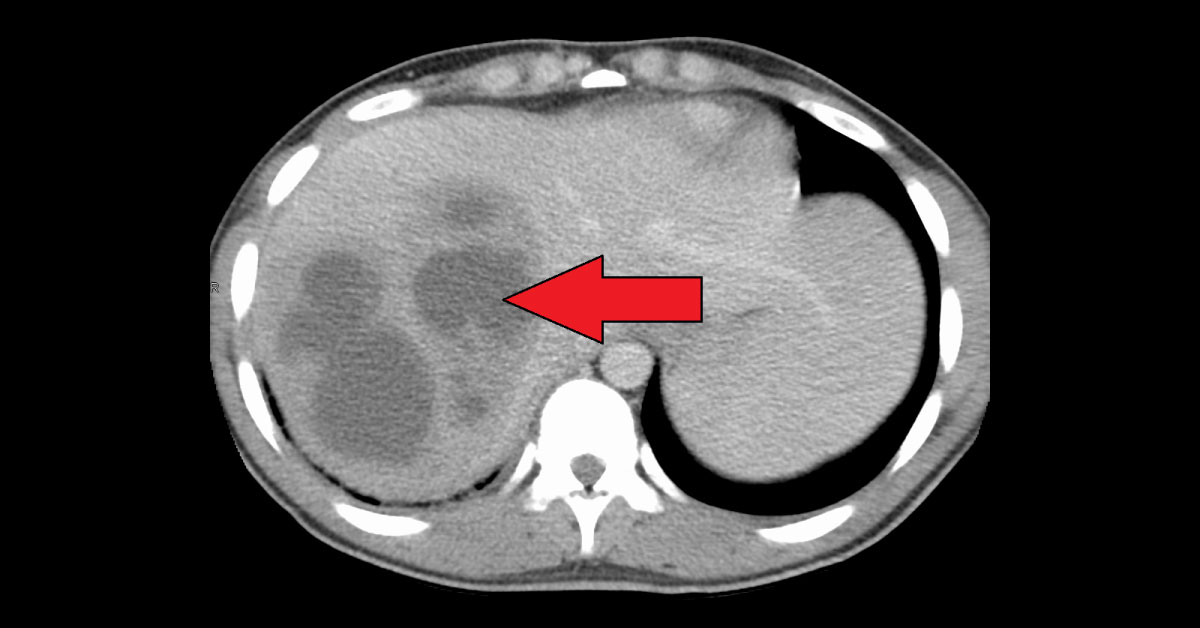 Identify These Radiologic Findings