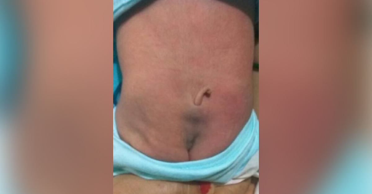 Diagnose This Condition