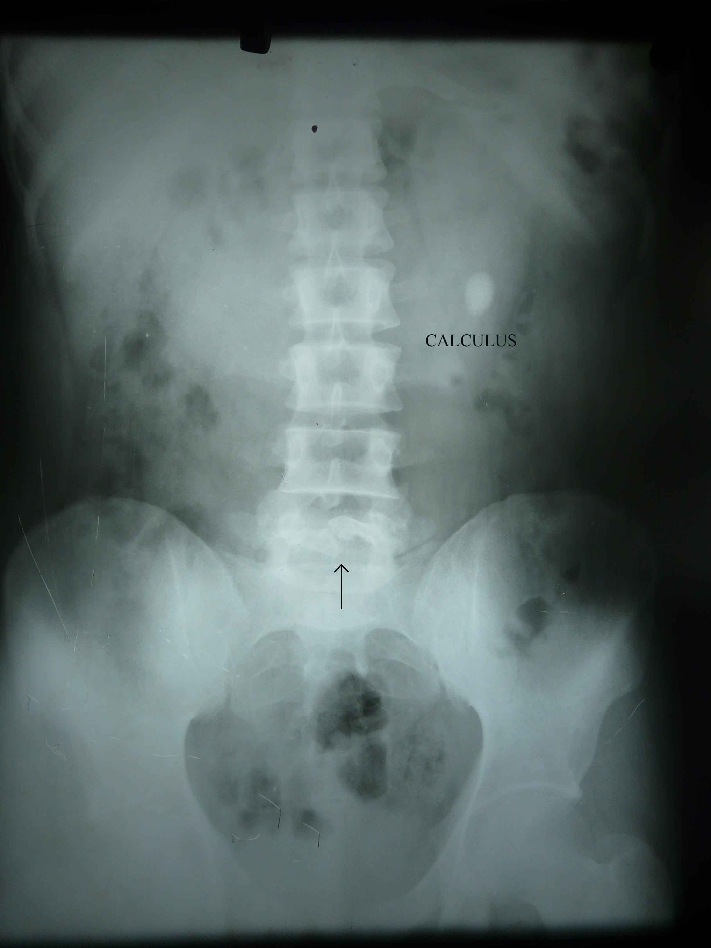 Interpret The X-Ray Films