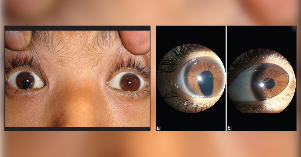 Spot The Ophtalmology Condition