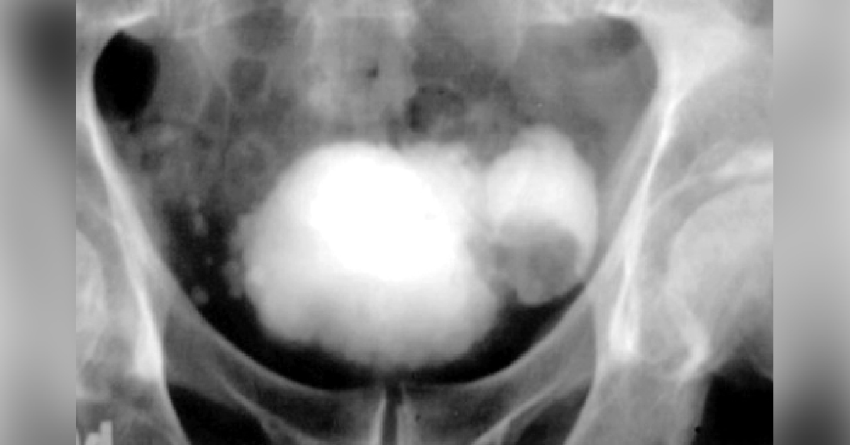 Diagnose From The Image Only
