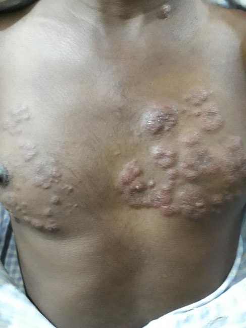 Diagnose The Derma Case