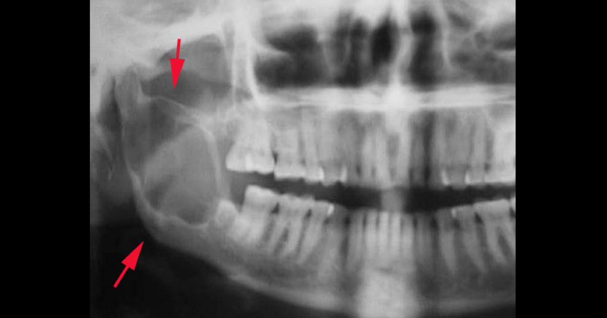Identify The Condition