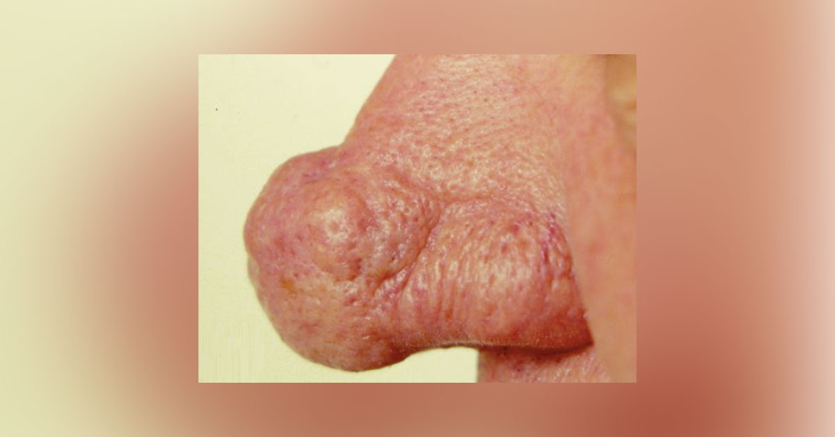 Spot the Condition
