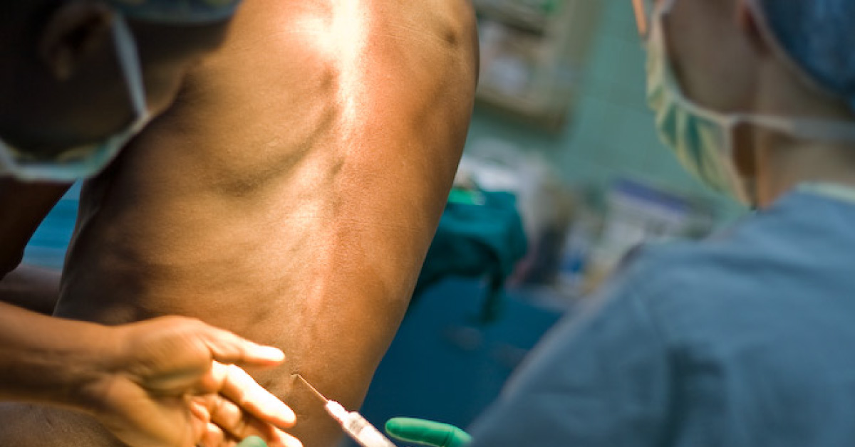 Risks And Benefits Of Spinal Anesthesia