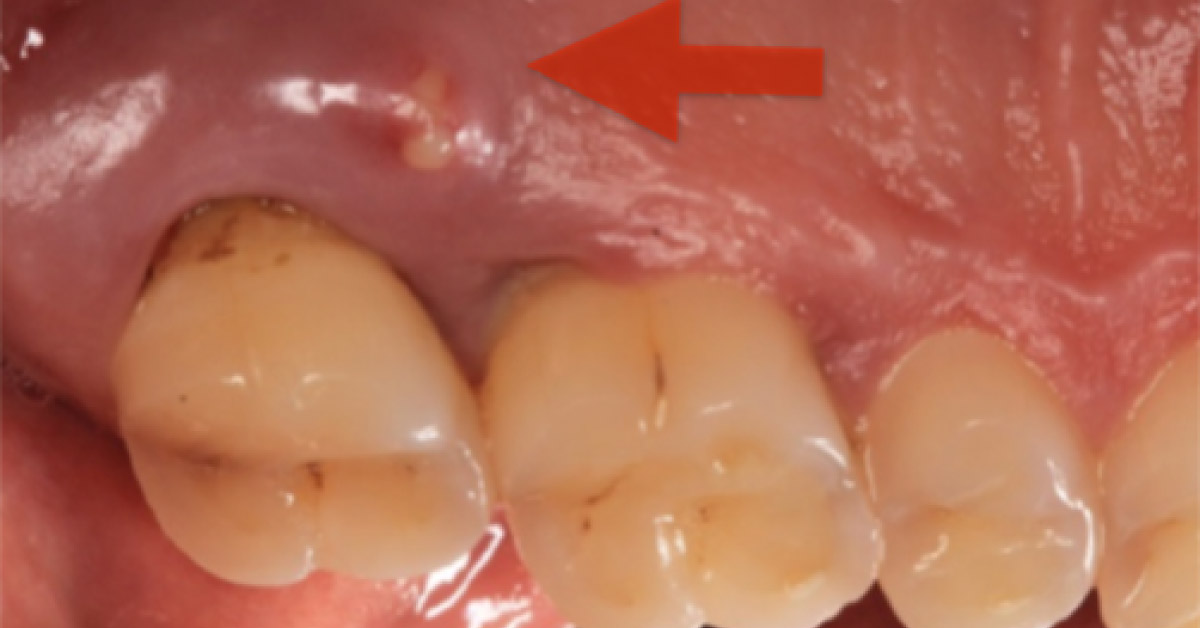 Diagnose Dental Problem Of The Patient