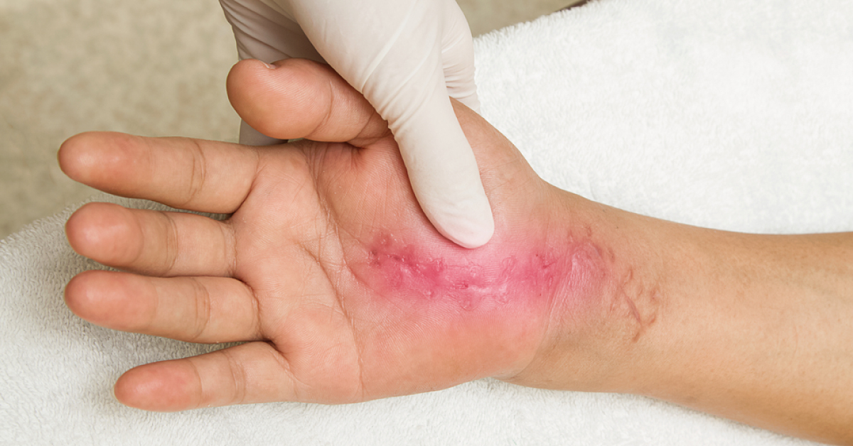 A Checklist To Determine Differential Diagnosis Of Hand Diseases